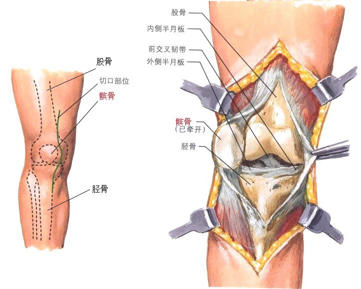 膝关节及髌骨解剖图